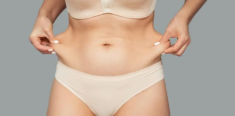 Abdomen con flacidez