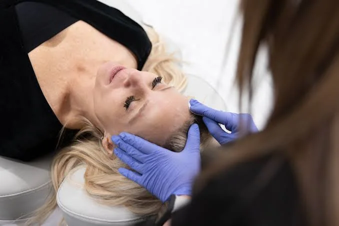 Aplicación de un peeling químico en el rostro